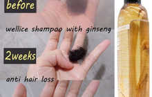 Шампунь Wellice против выпадения волос