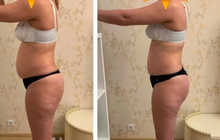 Я — сертифицированный массажист, помогаю снять напряжение, убрать зажимы и вернуть лёгкость в теле. Работаю бережно, но эффективно — с вниманием к каждому клиенту и его запросу. В моей практике: ✨ антицеллюлитный и моделирующий массаж ✨ лимфодренаж ✨ расс